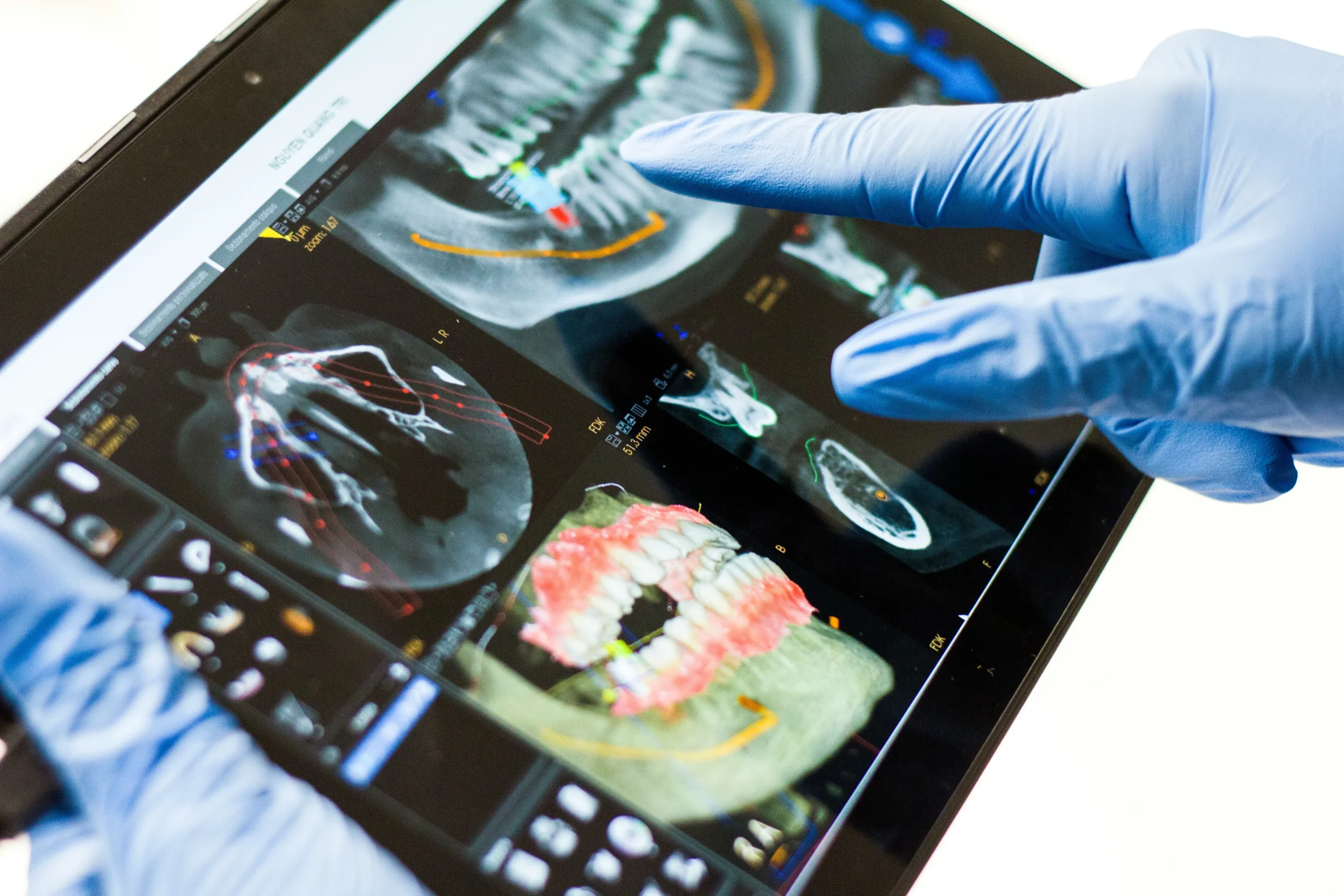 Complete Guide to Dental Treatment Costs in Singapore 2026